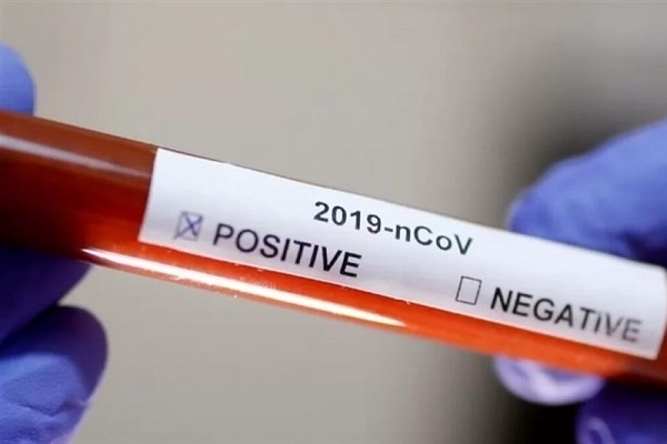 آغاز پلاسما درمانی مبتلایان کرونا در ایران