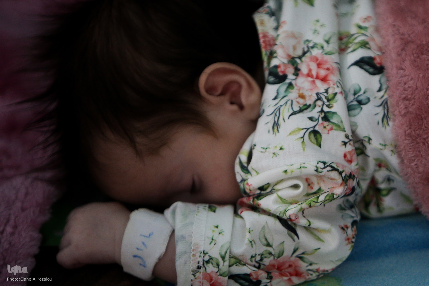 کبد ضعیف نوزادان و بلای درمان‌های خانگی